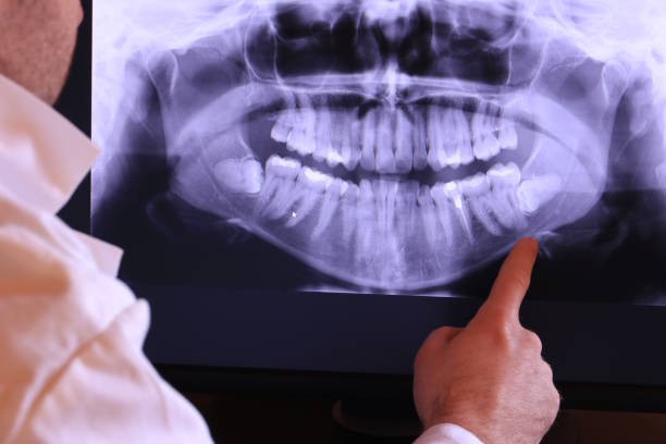 Best Root Canal Emergency Dentist  in Clifton Forge, VA